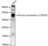 Western blot - Pituitary homeobox 2 (PITX2) Rabbit mAb (A22173)