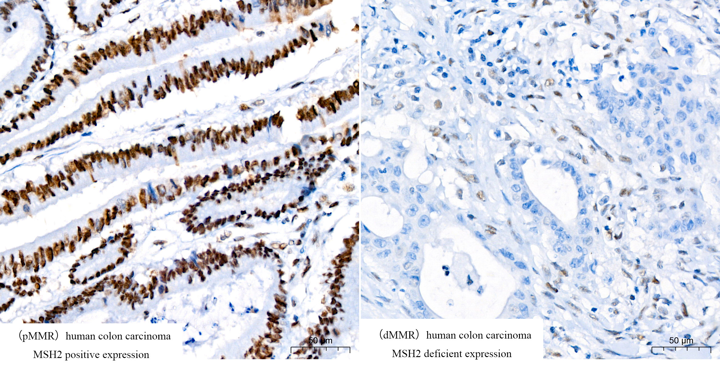 [KO Validated] MSH2 Rabbit monoclonal antibody