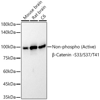 Non-phospho (Active)β-Catenin -S33/S37/T41 Rabbit mAb