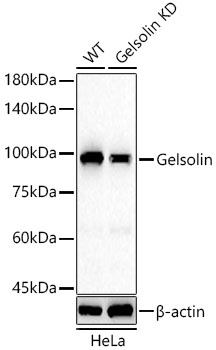 [KD Validated] Gelsolin Rabbit monoclonal antibody