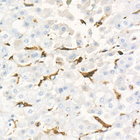 [KD Validated] Gelsolin Rabbit monoclonal antibody