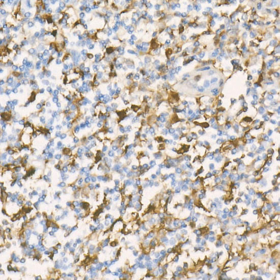 [KD Validated] Gelsolin Rabbit monoclonal antibody