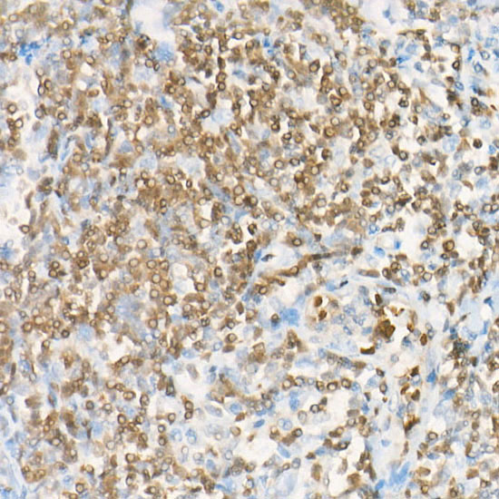 DGKA Rabbit monoclonal antibody