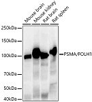 Western blot - PSMA/FOLH1 Rabbit mAb (A22212)