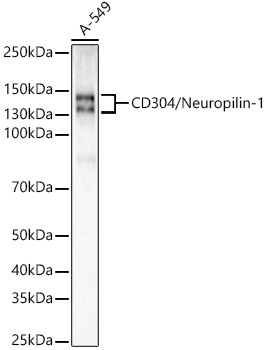 Neuropilin-1 (NRP1) Rabbit mAb