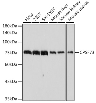 CPSF73 Rabbit monoclonal antibody