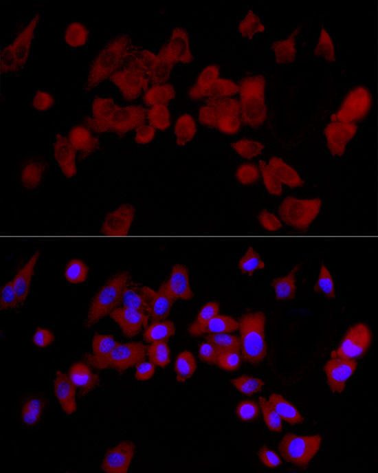 CYP3A4 Rabbit monoclonal antibody