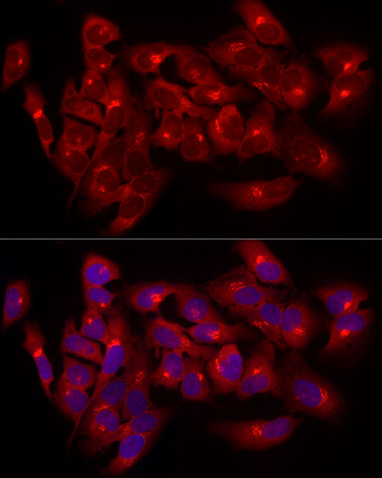 Giantin Rabbit polyclonal antibody