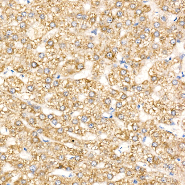 HADHA Rabbit polyclonal antibody
