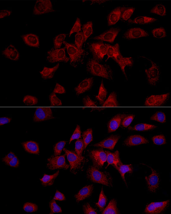 HADHA Rabbit polyclonal antibody