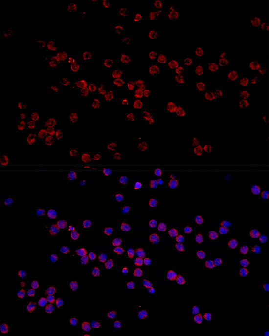 HADHA Rabbit polyclonal antibody