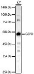 Western blot - [KD Validated] G6PD Rabbit pAb (A22242)