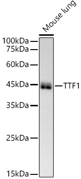 NKX2-1 Rabbit monoclonal antibody