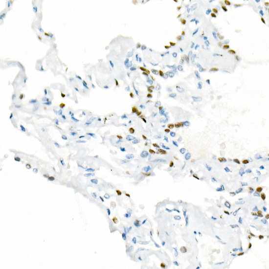 NKX2-1 Rabbit monoclonal antibody