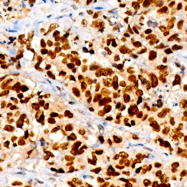 NKX2-1 Rabbit monoclonal antibody