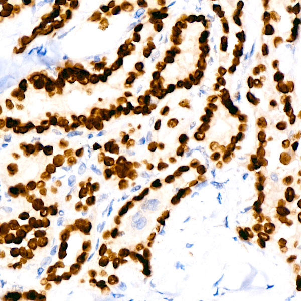 NKX2-1 Rabbit monoclonal antibody