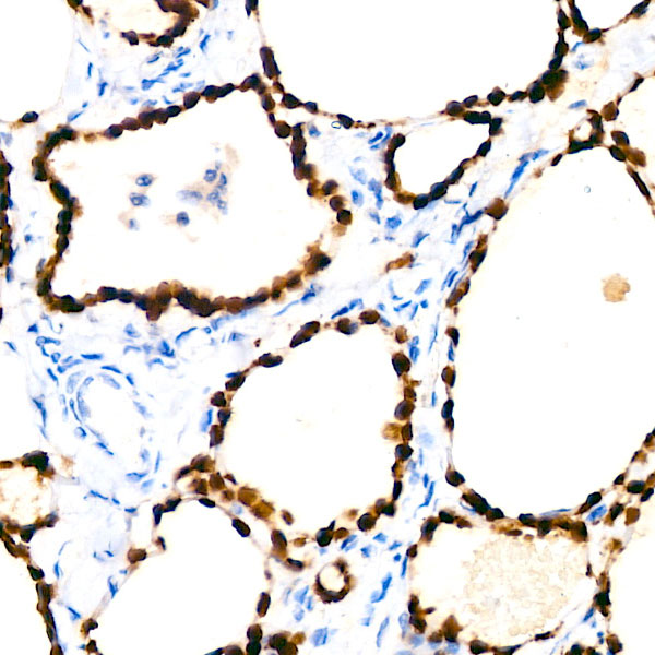 NKX2-1 Rabbit monoclonal antibody