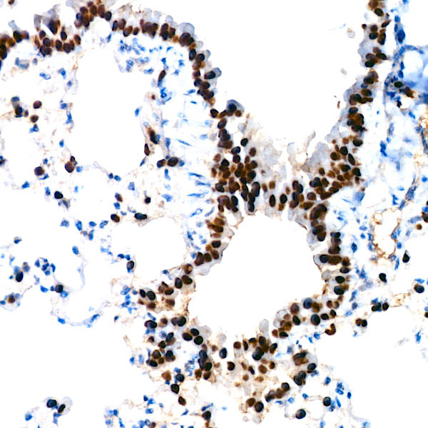 NKX2-1 Rabbit monoclonal antibody