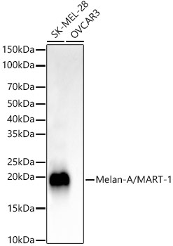 Melan-A/MART-1 Rabbit monoclonal antibody