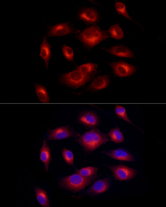 Melan-A/MART-1 Rabbit monoclonal antibody