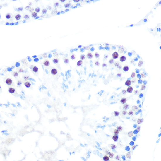 HDAC9 Rabbit monoclonal antibody