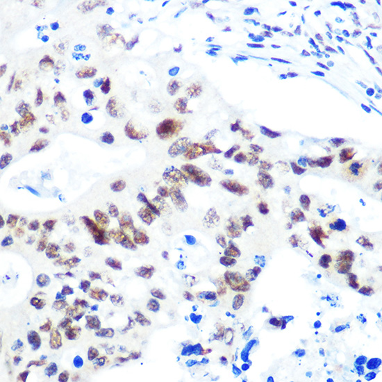 HDAC9 Rabbit monoclonal antibody