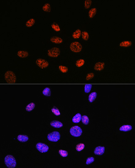 HDAC9 Rabbit monoclonal antibody