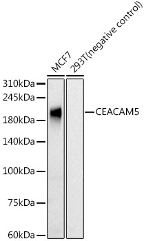[KO Validated] CEACAM5 Rabbit monoclonal antibody