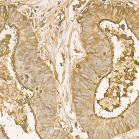 [KO Validated] CEACAM5 Rabbit monoclonal antibody