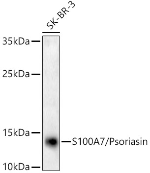 S100A7/Psoriasin Rabbit monoclonal antibody