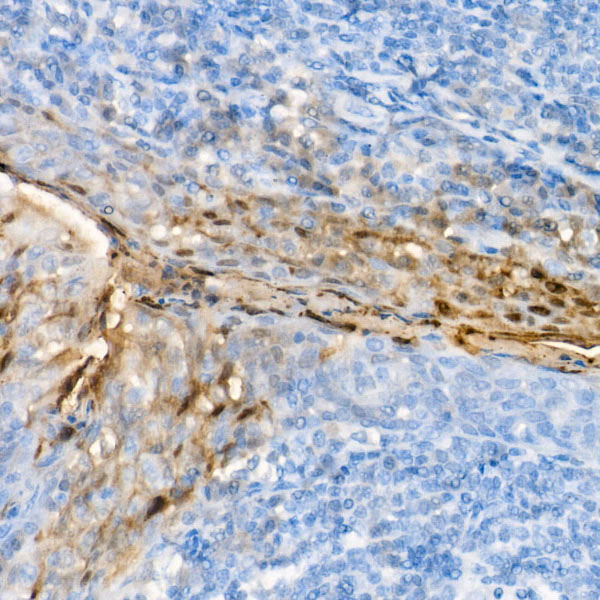 S100A7/Psoriasin Rabbit monoclonal antibody
