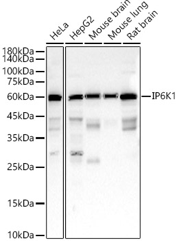 IP6K1 Rabbit monoclonal antibody
