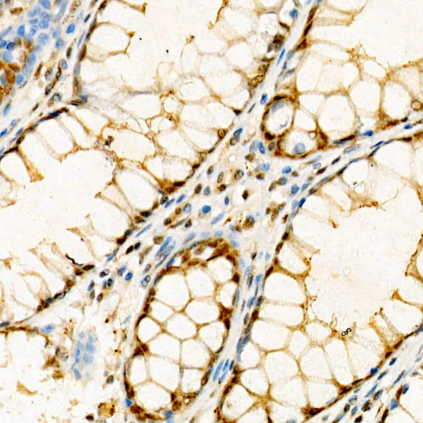 IP6K1 Rabbit monoclonal antibody