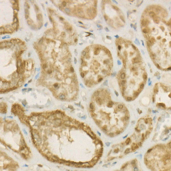 [KO Validated] ACLY Rabbit monoclonal antibody