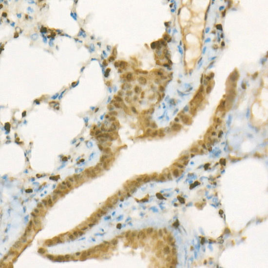 [KO Validated] ACLY Rabbit monoclonal antibody