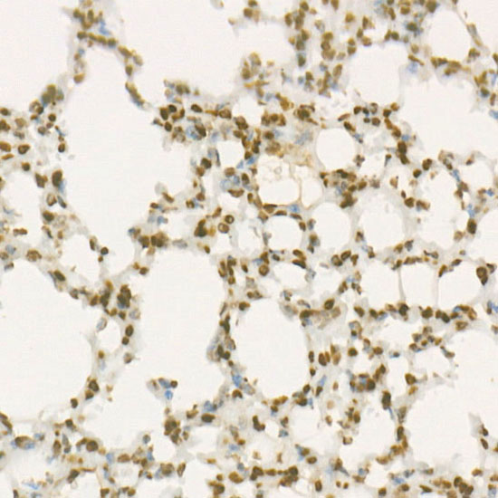 WEE1 Rabbit monoclonal antibody