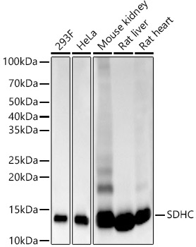 SDHC Rabbit monoclonal antibody