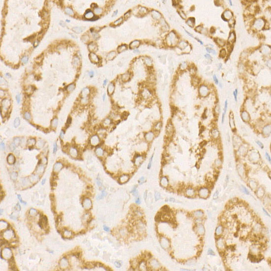 SDHC Rabbit monoclonal antibody
