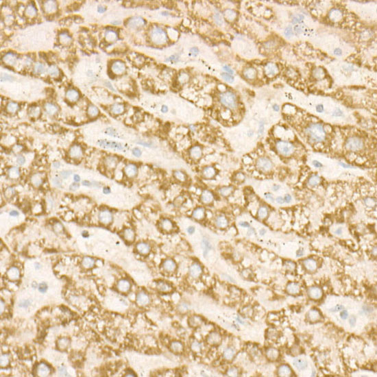 SDHC Rabbit monoclonal antibody