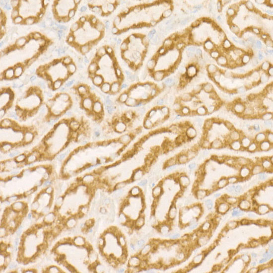 SDHC Rabbit monoclonal antibody