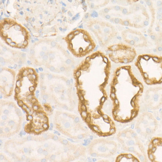SDHC Rabbit monoclonal antibody