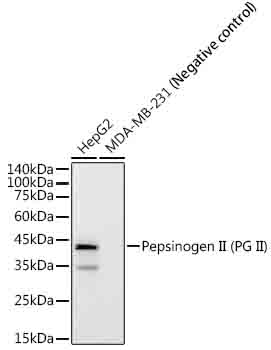 Pepsinogen II (PG II) Rabbit monoclonal antibody