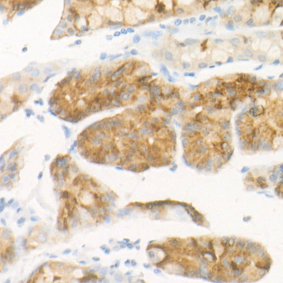 Pepsinogen II (PG II) Rabbit monoclonal antibody