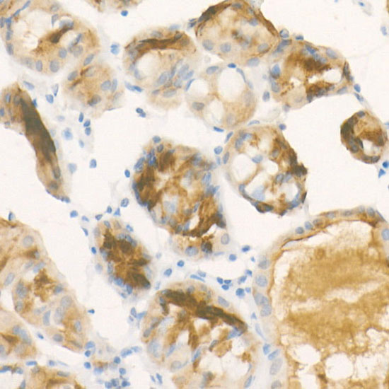 Pepsinogen II (PG II) Rabbit monoclonal antibody