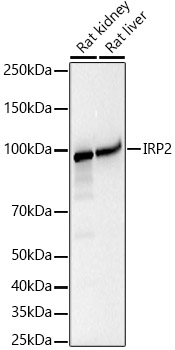 IRP2 Rabbit monoclonal antibody