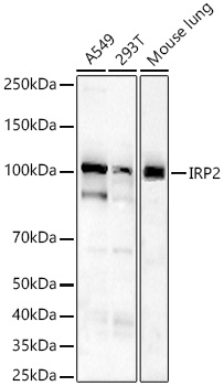 IRP2 Rabbit monoclonal antibody