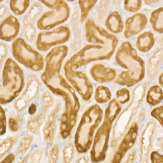 IRP2 Rabbit monoclonal antibody