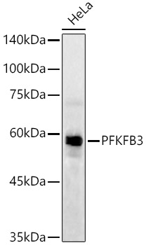 PFKFB3 Rabbit monoclonal antibody