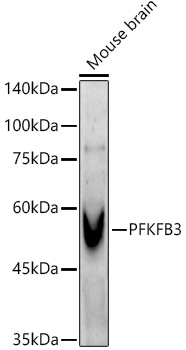 PFKFB3 Rabbit monoclonal antibody