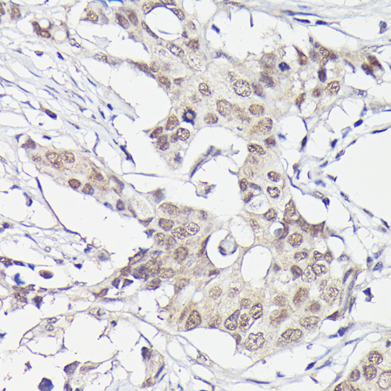 PFKFB3 Rabbit monoclonal antibody